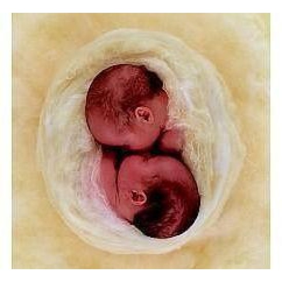 Tweelingen Anne Geddes